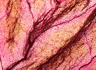 Problemy ze skórą i stawami w perimenopauzie 